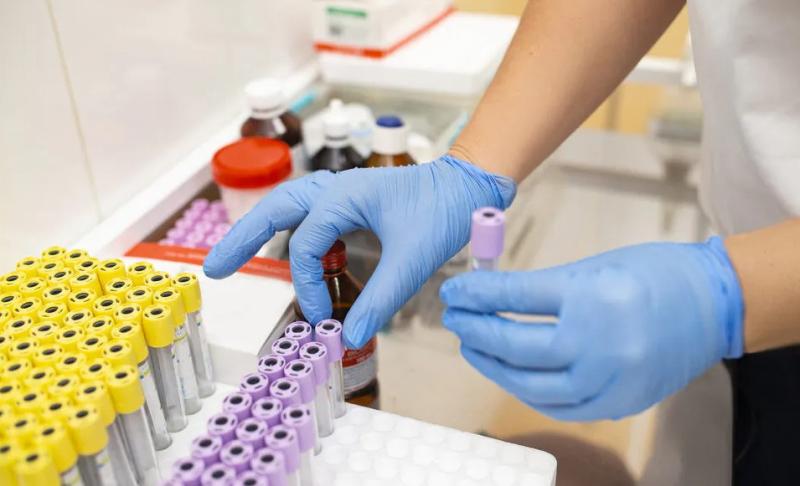 Πιτσούνη Ελένη | Μικροβιολογικές εξετάσεις - Εξετάσεις αίματος - Μικροβιολογικό εργαστήριο Παπάγου Αττική